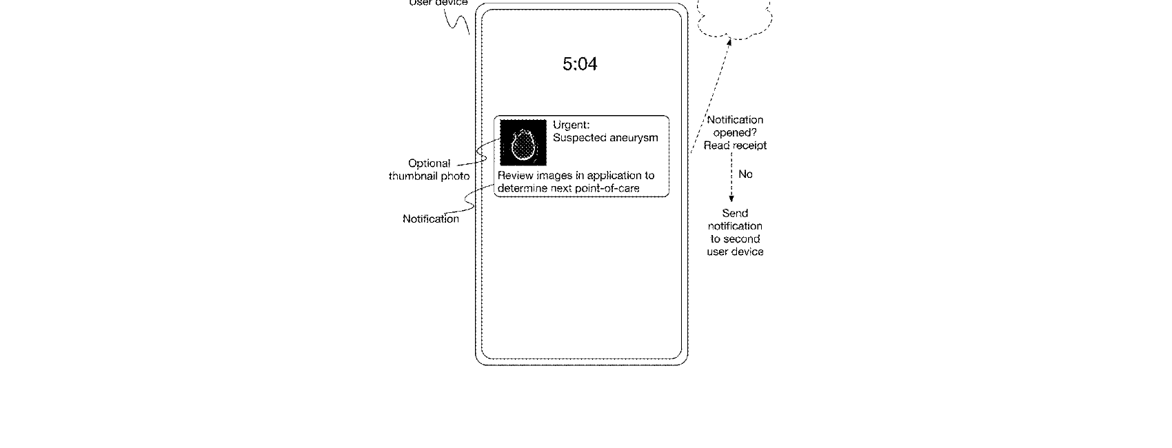 Figure for METHOD AND SYSTEM FOR COMPUTER-AIDED ANEURYSM TRIAGE