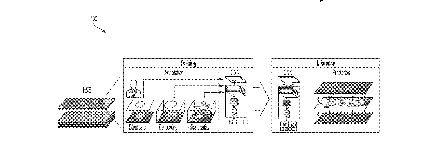 Figure for SYSTEMS AND METHODS FOR ASSESSING LIVER PATHOLOGY
