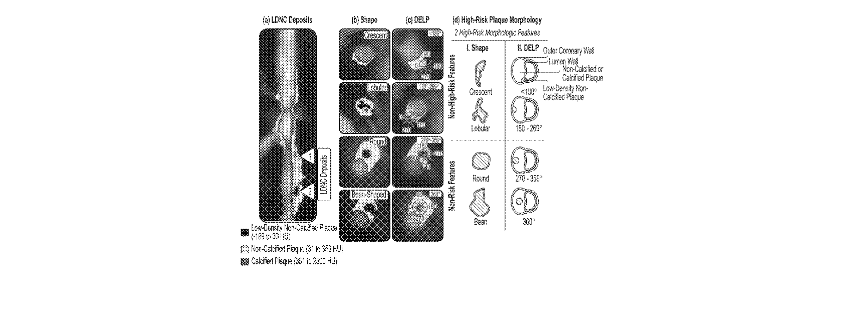 Figure for SYSTEMS, DEVICES, AND METHODS FOR NON-INVASIVE IMAGE-BASED PLAQUE ANALYSIS AND RISK DETERMINATION