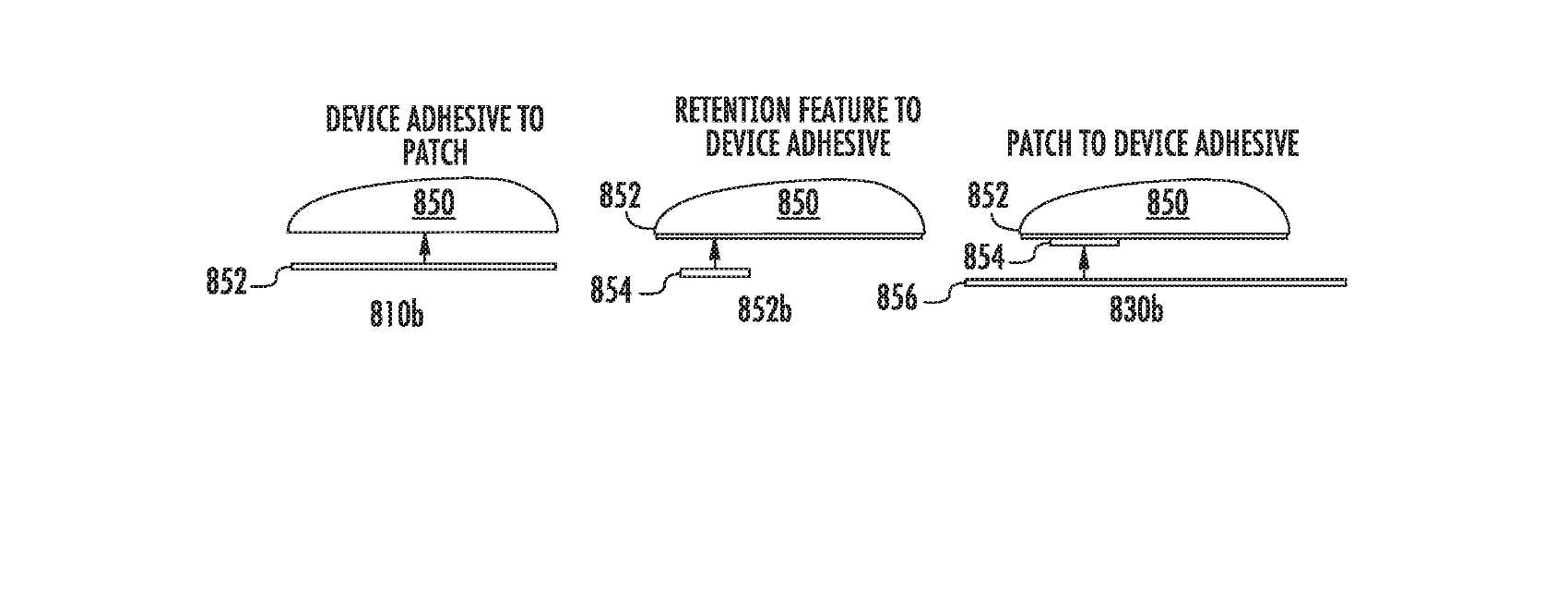 Figure for INVASIVE BIOSENSOR ALIGNMENT AND RETENTION