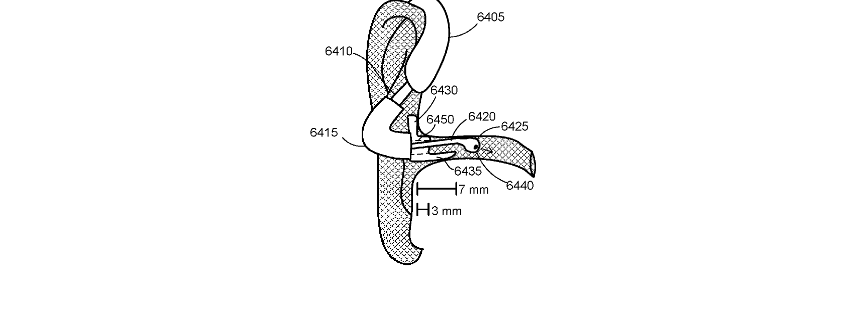 Figure for DEVICES FOR AT-HOME PHYSICAL EXAMINATION OF THE EAR AND EAR CANAL