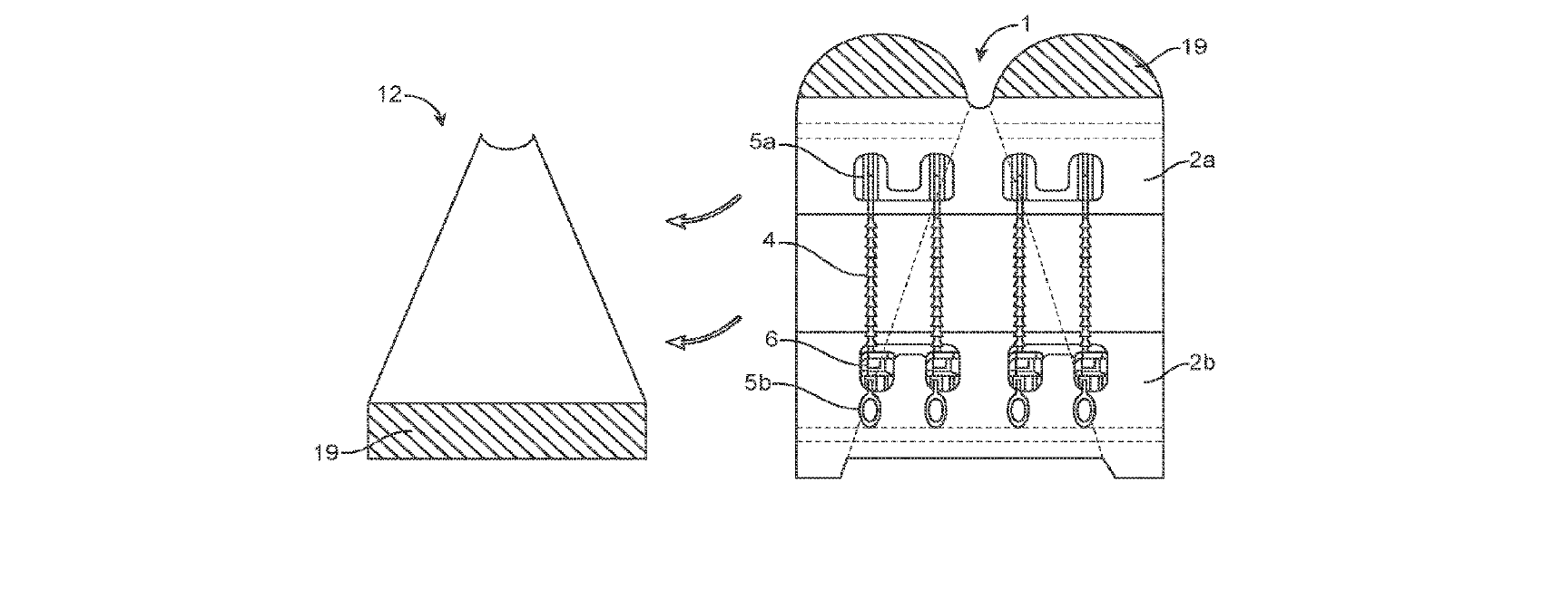Figure for Closure Apparatuses and Methods for Ulcers and Irregular Skin Defects
